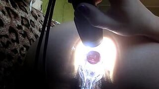 gynecological speculum in anal - porn video